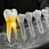 AI Revolution in Dentistry: How Next-Gen Object Detection is Automating Periapical Disease Diagnosis